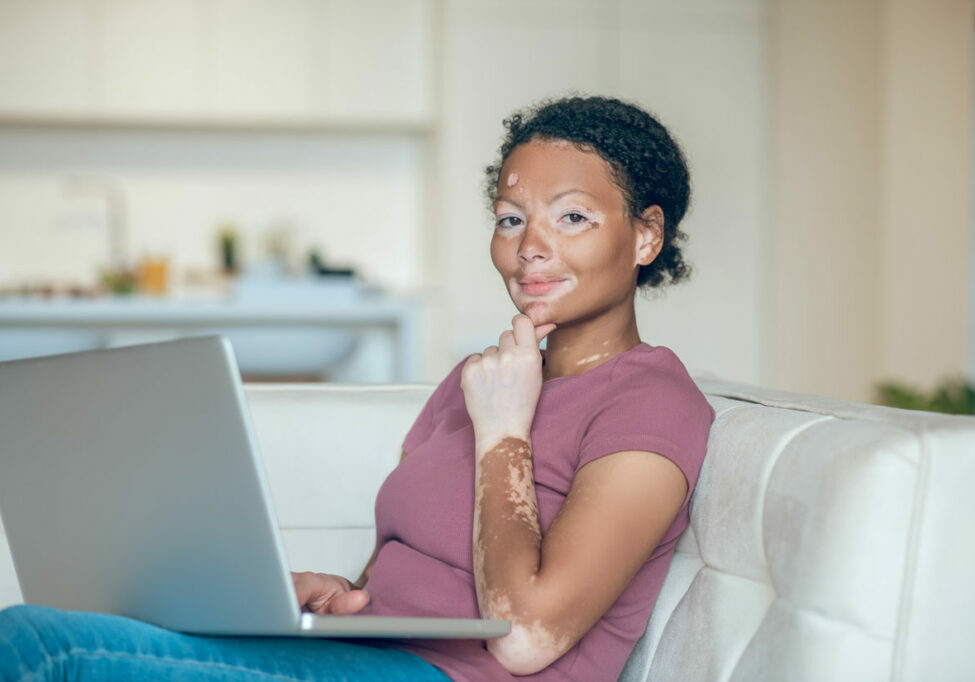 Is-Vitiligo-An-Autoimmune-Disease--Understanding-The-Immune-Connection-To-This-Skin-Condition