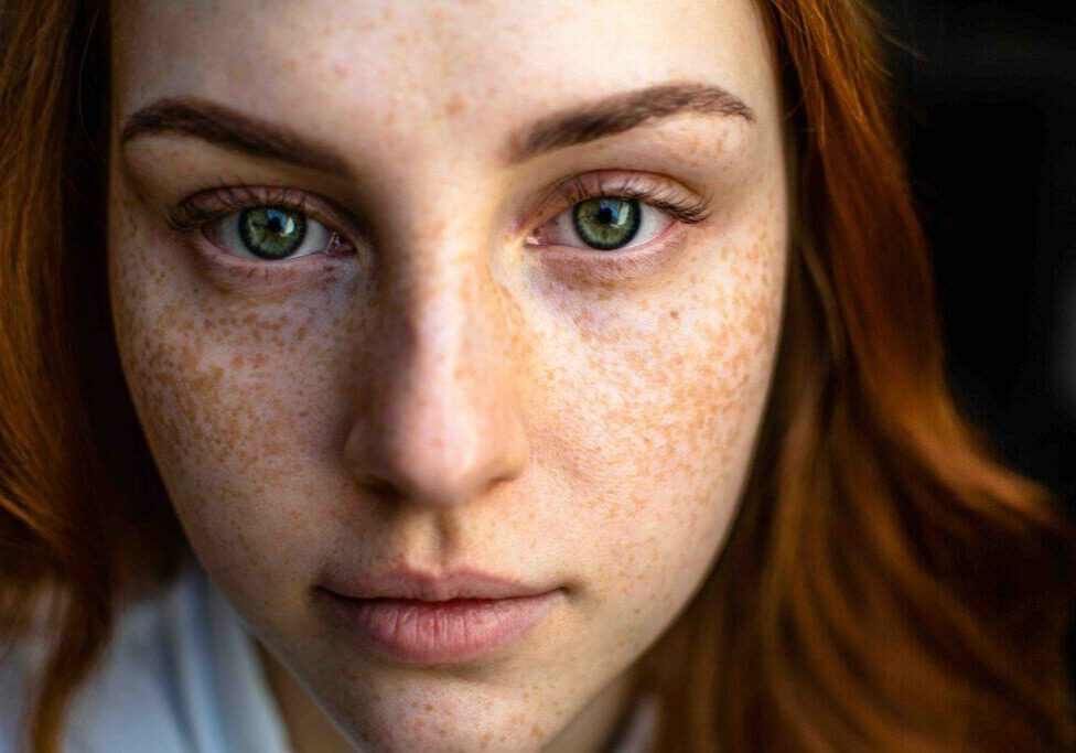 What Is Hormonal Acne? Why It Happens + How To Help, According To A Functional Medicine Expert Dr. Will Cole